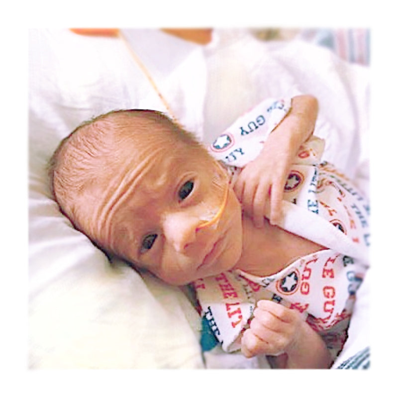 Why Do we use Velcro on our preemie clothes?